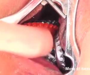 Kroondoppen in haar kut, dat moet pijn doen!