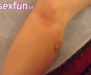 Wil je niet zien: brandmerken